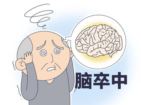 我国学者在《柳叶刀》首次发现脑卒中患者取栓再通后血压管理下限——有望改写指南!