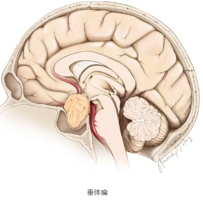 一女子饭店吃饭时被陌生男人提醒脑子里有肿瘤!是骗子还是医者仁心?