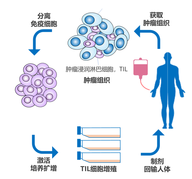 [TILs免疫细胞疗法]用自己的免疫细胞杀灭肿瘤将实现!癌症患者的新希望!临床试验进行中