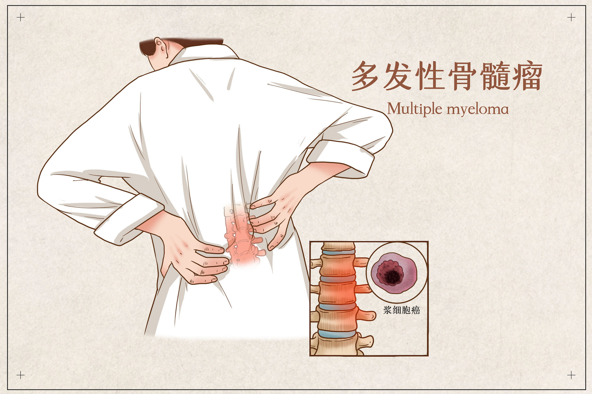 达雷妥尤单抗的价格