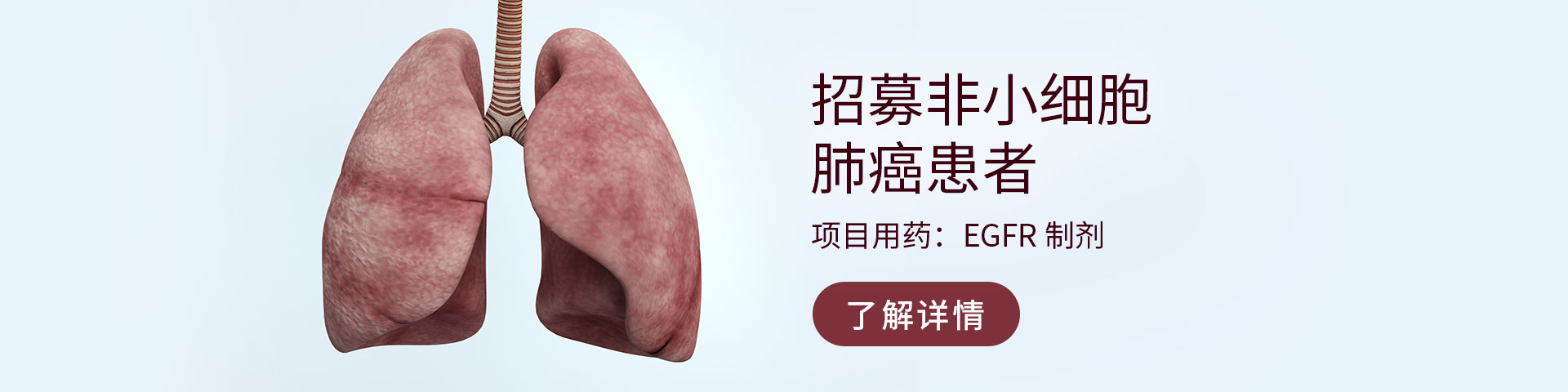 临床试验招募非小细胞肺癌患者