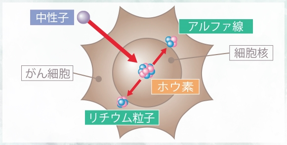 硼中子治疗系统的作用有哪些？有没有硼中子治疗招志愿者的项目？