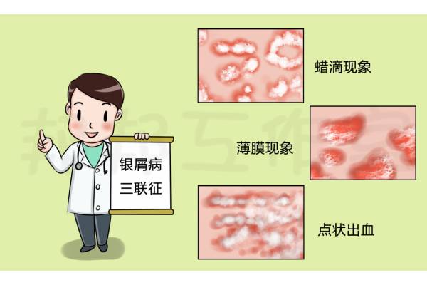 如何申请银屑病靶向药的免费治疗?银屑病靶向药免费治疗需要满足哪些条件?